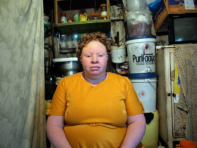 amani-albinism-kibera-1