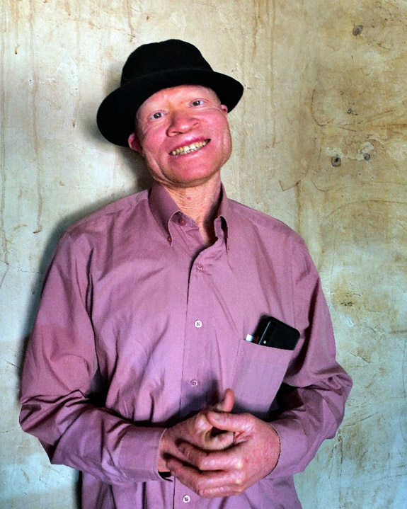 tumaini-albinism-kibera-1